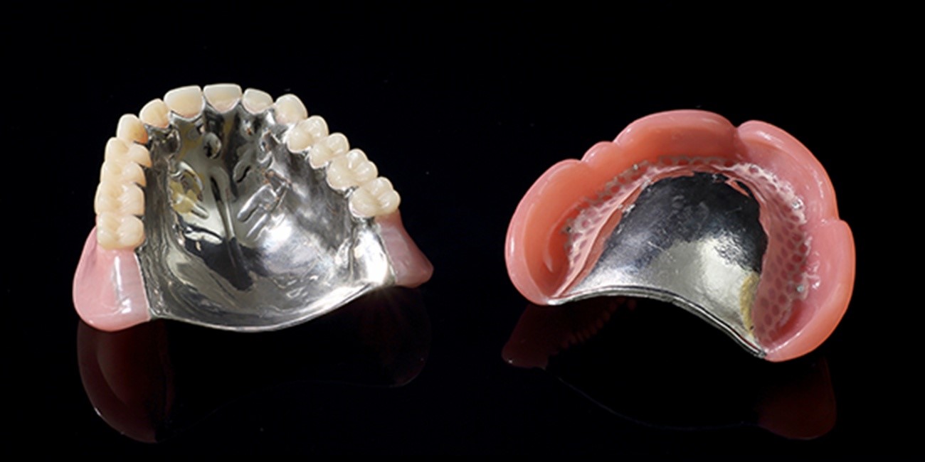 金属床|たまプラーザの歯医者・入れ歯dentalclinicCたまプラーザ