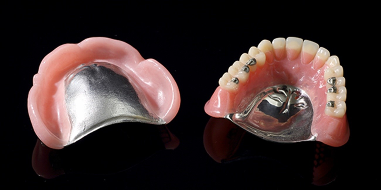 チタン床|たまプラーザの歯医者・入れ歯dentalclinicCたまプラーザ