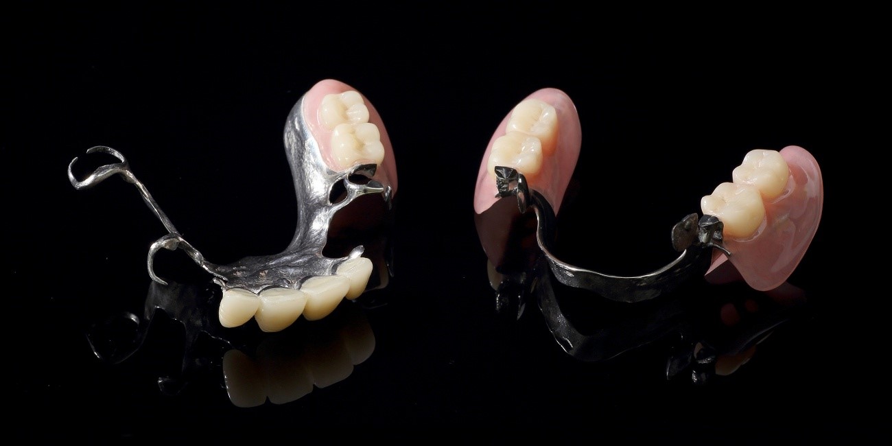 アタッチメントデンチャー(部分入れ歯)|たまプラーザの歯医者・入れ歯dentalclinicCたまプラーザ