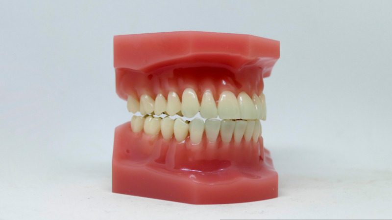 歯並びをきれいにする方法｜治療の種類・費用・期間を解説